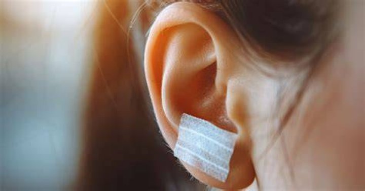 耳たぶに絆創膏を貼る正しい方法と効果的な使い方